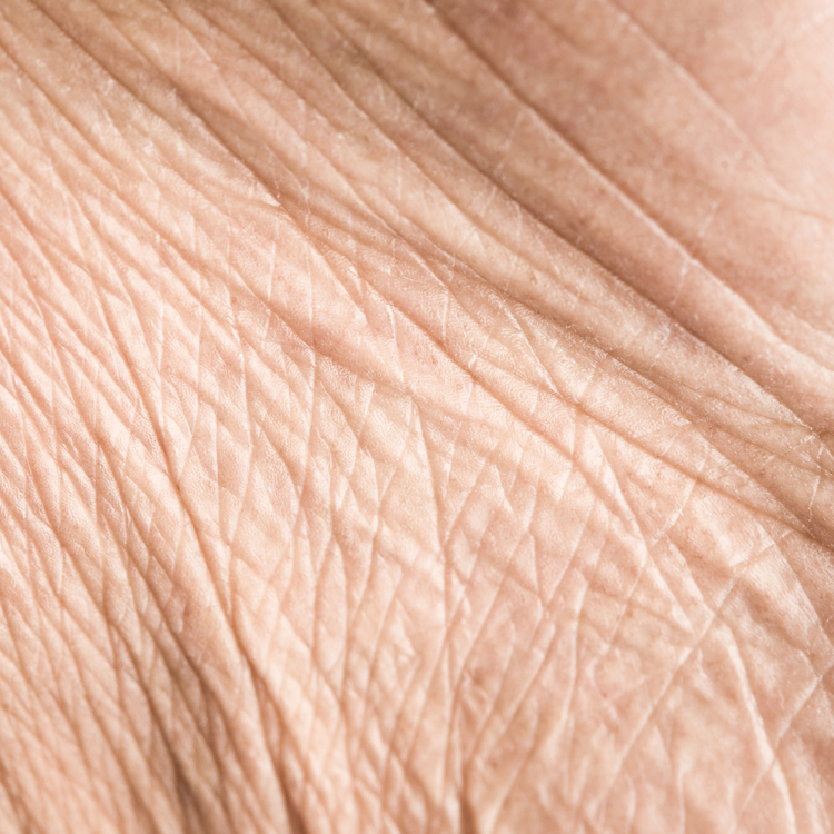 Ageing Skin