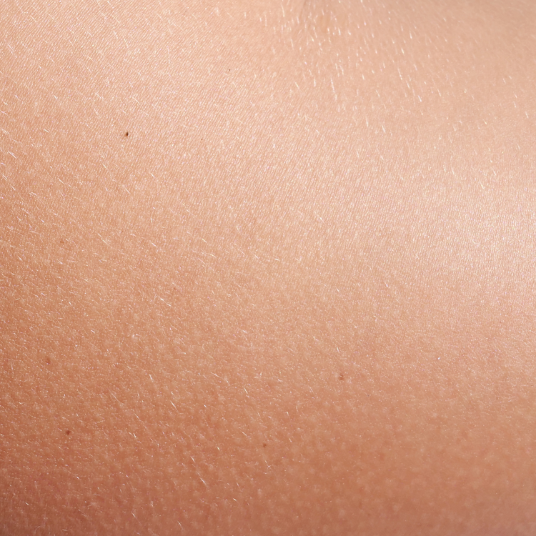 Normal Skin